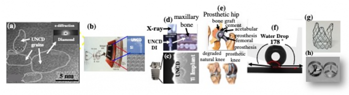 Figure 1. (a) High-resolution transmission electron microscopy image of UNCDTM coating, showing 3-5 nm grains; (b) Schematic of Si microchip (artificial retina)-left/cross-section scanning electron microscopy (SEM-top right) image of UNCD-encapsulated microchip and electrodes (bottom) made of Si tips coated with unique electrically conductive N atoms-doped N-UNCD coating. Injecting electrons in ganglion cells, transferring to the brain to produce an image; (c) Cross-section SEM image of UNCD-coated DI; (d) X-ray image of UNCD- coated DI (upper left) and UNCD-coated DI in maxillary bone of one of 51 patients implanted with UNCD-coated DI in clinical trials (2018 to present); (e) Schematics of artificial hip (top)/knee (bottom) to be coated with UNCDTM; (f) Water drop contact angle (178 ̊) on CF4 plasma processed UNCDTM surface, showing highest super-hydrophobicity of any known biomaterial, inhibiting blood cells adhesion on stent’s surface (Fig. 1(g))/heart valve’s surface (Fig. 1 (h)), eliminating thrombus formation. (5)