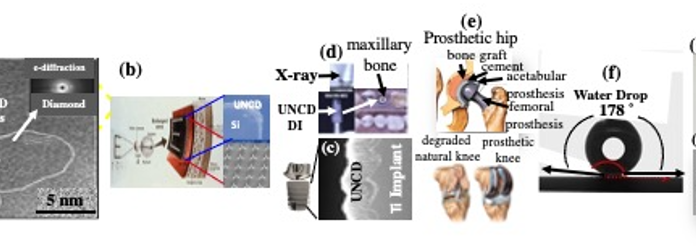 Figure 1. (a) High-resolution transmission electron microscopy image of UNCDTM coating, showing 3-5 nm grains; (b) Schematic of Si microchip (artificial retina)-left/cross-section scanning electron microscopy (SEM-top right) image of UNCD-encapsulated microchip and electrodes (bottom) made of Si tips coated with unique electrically conductive N atoms-doped N-UNCD coating. Injecting electrons in ganglion cells, transferring to the brain to produce an image; (c) Cross-section SEM image of UNCD-coated DI; (d) X-ray image of UNCD- coated DI (upper left) and UNCD-coated DI in maxillary bone of one of 51 patients implanted with UNCD-coated DI in clinical trials (2018 to present); (e) Schematics of artificial hip (top)/knee (bottom) to be coated with UNCDTM; (f) Water drop contact angle (178 ̊) on CF4 plasma processed UNCDTM surface, showing highest super-hydrophobicity of any known biomaterial, inhibiting blood cells adhesion on stent’s surface (Fig. 1(g))/heart valve’s surface (Fig. 1 (h)), eliminating thrombus formation. (5)