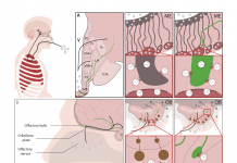 Figure 1. Two routes of brain infection by which SARS-CoV-2 may enter the hypothalamus and infect GnRH neurons. The virus attaches to and enters cells harbouring surface receptors such as ACE2 (black spanner-like symbol) or NRP1 (red cylinder). GnRH neurons exhibit both, which might increase their vulnerability. A. The haematological route, whereby the respiratory virus (white spheres) makes its way through the lungs into the bloodstream (dark red), and thence into the median eminence (ME), a part of the hypothalamus that harbours ”fenestrated” or leaky blood vessels. The virus may affect a number of different cell types locally, including GnRH neurons (green), whose secretory terminals approach the fenestrated vessels, and tanycytes (grey), whose processes control this secretion and also transport other bloodborne hormones and other substances into the brain. Once inside the brain ventricles (V), fluid-filled canals within the brain, the virus can also travel to other areas. B. The olfactory route, whereby the virus enters the olfactory bulb (OB) of the brain directly from the nose across the bony cribriform plate by means of nerve bundles or infected olfactory neurons and other cell types. GnRH neurons, which are born in the nasal epithelium during the embryonic period and migrate into the brain along these nerve bundles to their final positions, still maintain a connection with their birthplace, and could be thus be infected directly or indirectly through olfactory neurons or other cells. GnRH neurons also project to parts of the brain involved in higher functions such as cognition, potentially contributing to long-COVID symptoms such as “brain fog”.