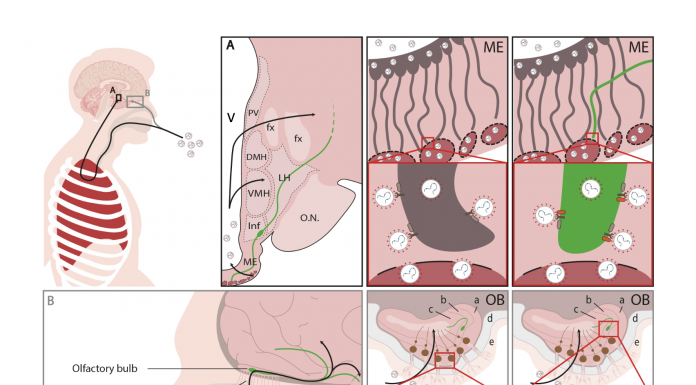 Figure 1. Two routes of brain infection by which SARS-CoV-2 may enter the hypothalamus and infect GnRH neurons. The virus attaches to and enters cells harbouring surface receptors such as ACE2 (black spanner-like symbol) or NRP1 (red cylinder). GnRH neurons exhibit both, which might increase their vulnerability. A. The haematological route, whereby the respiratory virus (white spheres) makes its way through the lungs into the bloodstream (dark red), and thence into the median eminence (ME), a part of the hypothalamus that harbours ”fenestrated” or leaky blood vessels. The virus may affect a number of different cell types locally, including GnRH neurons (green), whose secretory terminals approach the fenestrated vessels, and tanycytes (grey), whose processes control this secretion and also transport other bloodborne hormones and other substances into the brain. Once inside the brain ventricles (V), fluid-filled canals within the brain, the virus can also travel to other areas. B. The olfactory route, whereby the virus enters the olfactory bulb (OB) of the brain directly from the nose across the bony cribriform plate by means of nerve bundles or infected olfactory neurons and other cell types. GnRH neurons, which are born in the nasal epithelium during the embryonic period and migrate into the brain along these nerve bundles to their final positions, still maintain a connection with their birthplace, and could be thus be infected directly or indirectly through olfactory neurons or other cells. GnRH neurons also project to parts of the brain involved in higher functions such as cognition, potentially contributing to long-COVID symptoms such as “brain fog”.