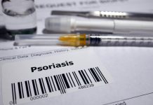 Psoriasis biopsy