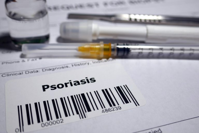 Psoriasis biopsy