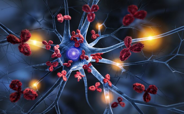 Nerve cell attacked by Antibodies