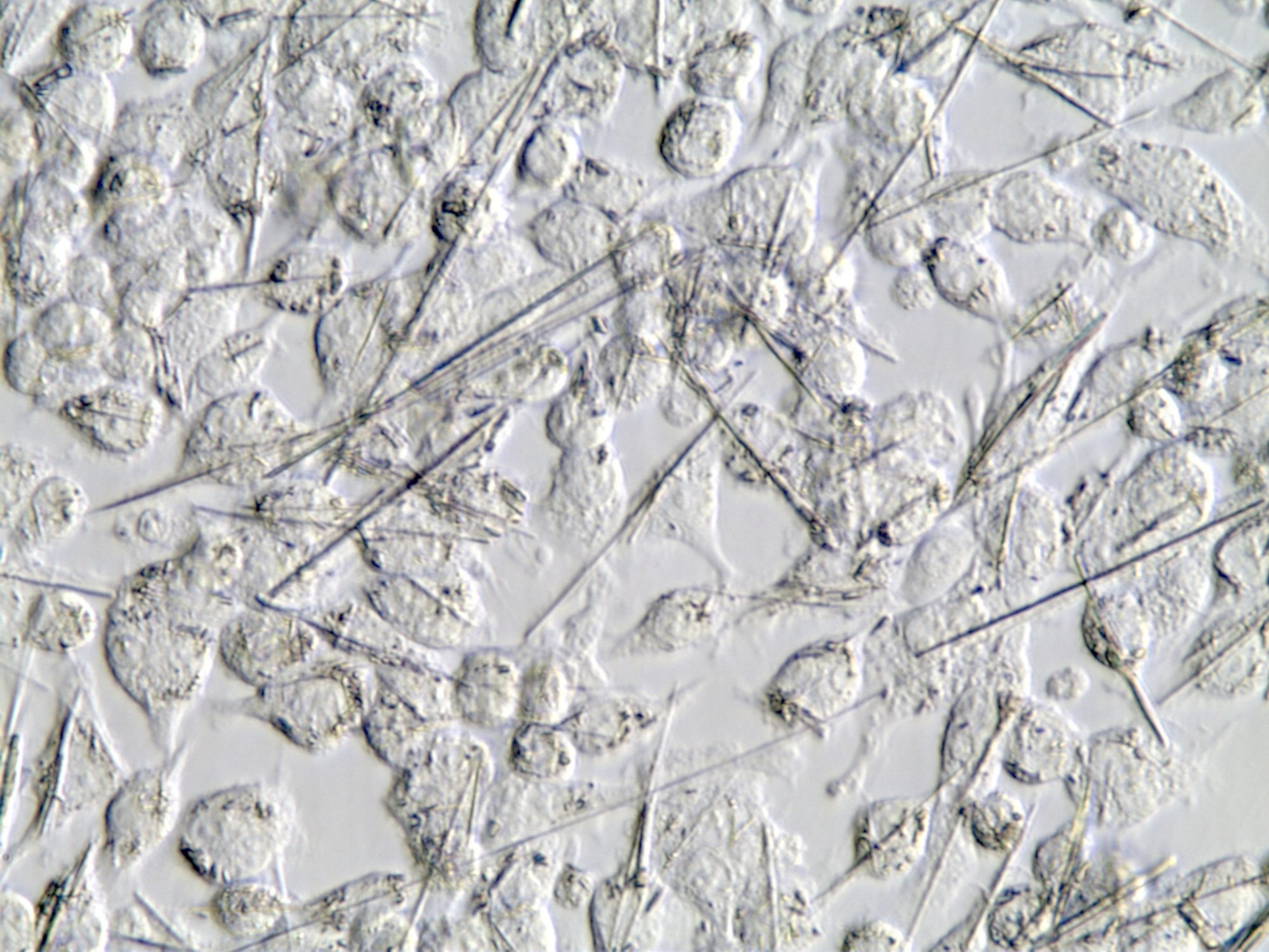 Amphibole fibers with cells
