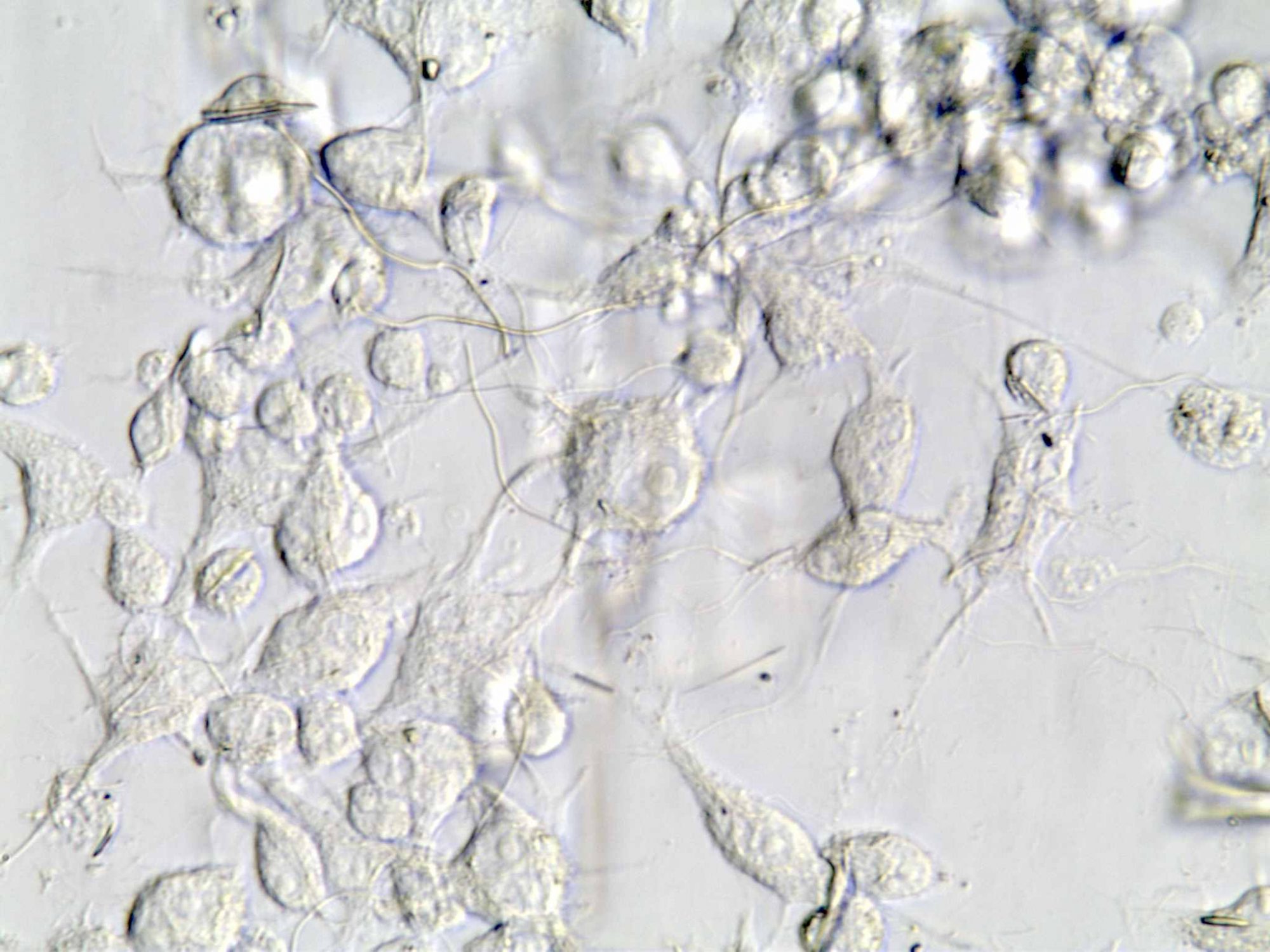 Chrysotile fibers with cells