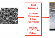 Figure 1: Early research at Purdue University in the Webster lab that led to the formation of Nanovis, which now has over 3,000 FortiFixTM pedicle screws inserted in humans with no cases of implant failure, according to the Maude database. The industry standard of pedicle screw failures lies between 5 – 10% depending on the data assessed.