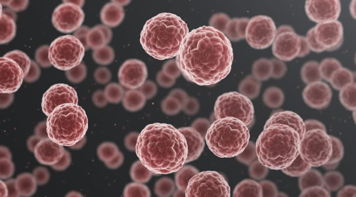 Cancer cells in human body, conceptual 3d illustration
