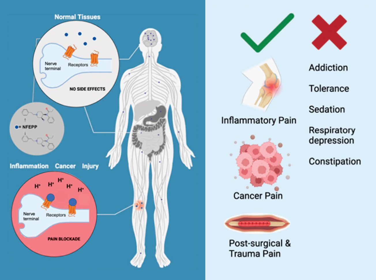 Figure 1: NFEPP’s targeted pain treatment is highly effective and lacks the risk of addiction and adverse side effects