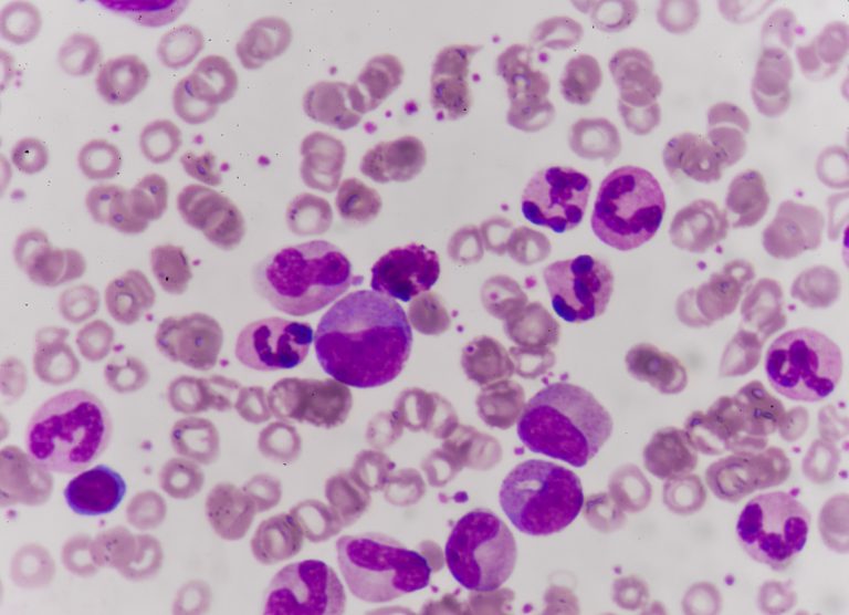 Leukemia blood cells medical science background concept.