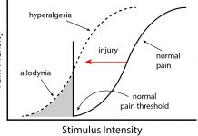 Figure 1: Abnormal pain response in IBD and Endometriosis.