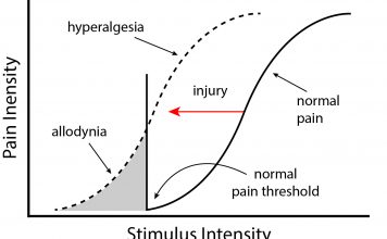 Figure 1: Abnormal pain response in IBD and Endometriosis.