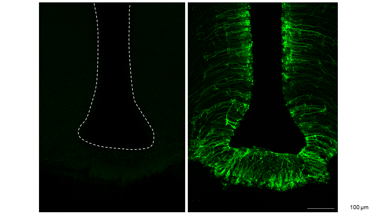 Figure 2: Dedicated gene therapy vectors target tanycytes, the cells that form the blood-brain barrier in the hypothalamus and coordinate metabolism and endocrine signalling. In genetically modified mice, the thyroid hormone transporter MCT8 is inactivated (left). After applying an AAV-based gene vector, MCT8 is re-expressed in tanycytes (right).