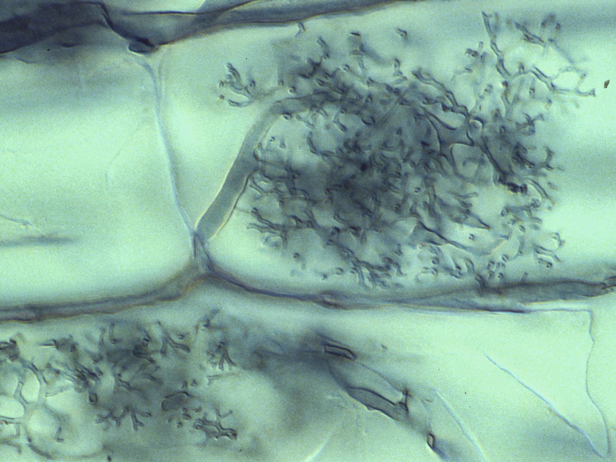 Arbuscule inside a cell of a leek root (Stained with Chlorazol Black E) Photo: Mark Brundrett