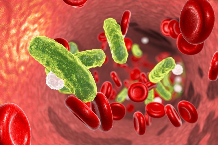 Sepsis, bacteria in blood