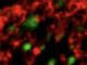 Still image of highly dynamic chromatin (red) interacts with Arc pucta (green). Shown is a small detail of a neuronal nucleus imaged by high-resolution microscopy. Notice how finger-like extensions of the chromatin transiently visit Arc pucta. The movie is sped up 10 times.