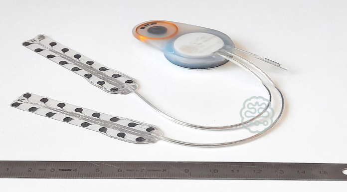 CorTec Brain Interchange Implant for Stroke Treatment