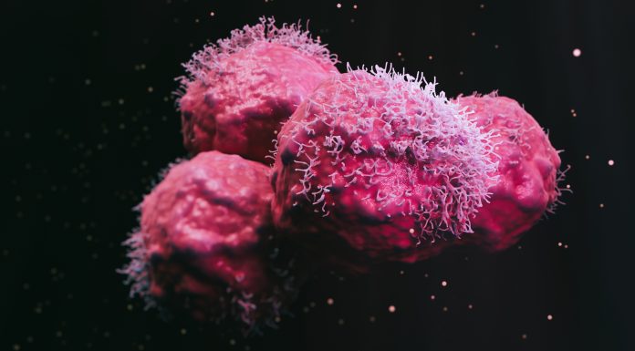 Cancer malignant cells - 3d rendered image, abstract enhanced scanning electron micrograph (SEM) of cancer malignant cells. Visual of overall shape of the cell's surface at a very high magnification. Medical research concept.