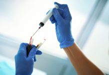 Blood test procedure.