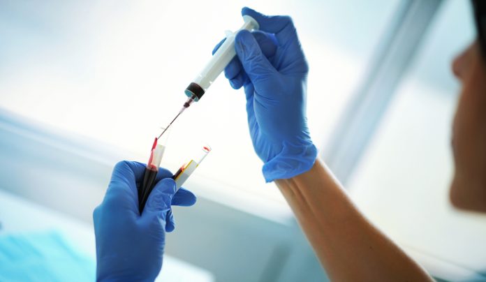 Blood test procedure.