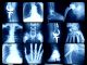 xray background