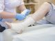 Nurse bandages the leg. Fracture of human lower limbs. Treatment of broken bones. Impose a gypsum. Patient surgical department. The doctor's hands tighten the bandage on his leg