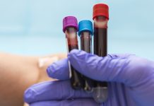 Blood test vials for blood groups held by nurse. Blood analysis concept, selective focus, copy space