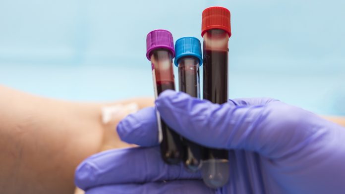 Blood test vials for blood groups held by nurse. Blood analysis concept, selective focus, copy space