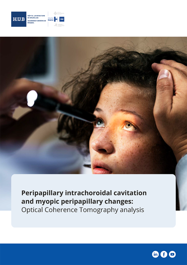 Peripapillary intrachoroidal cavitation and myopic peripapillary changes