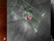 Figure 1. Peripapillary intrachoroidal cavitation (PICC) with a full-thickness defect within the myopic conus. (A). Fundus image showing a circumscribed yellow-orange lesion (black star) at the outer and inferior border of the myopic conus, corresponding to a peripapillary intrachoroidal cavitation. A full-thickness defect (red star) is located within the myopic conus. (B) Section along the green arrow of the infrared image, through the full-thickness defect (red star). The remnant of nerve fibers (yellow arrow) herniate into the PICC cavity. ONH = optic nerve head. Note: Reprinted from Peripapillary Intrachoroidal Cavitation. Adèle Ehongo et al. ‘J. Clin. Med. 2023, 12, 4712’ Originally published by and used with permission from MDPI.