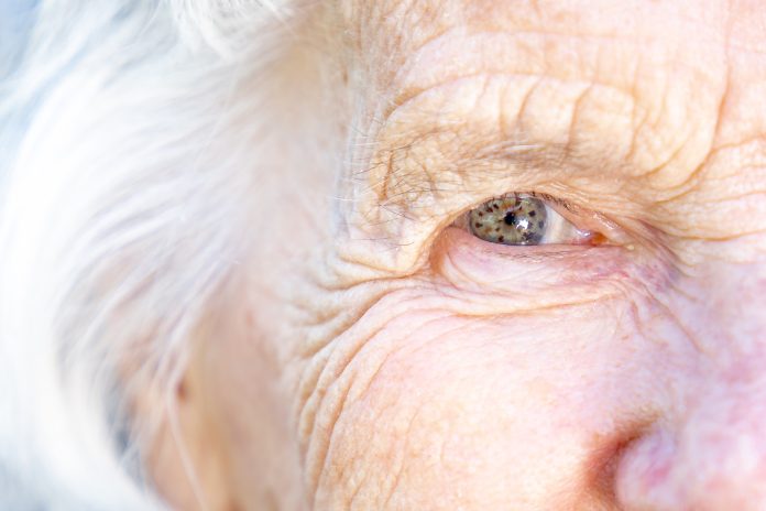 Extreme Close-Up Shot from above of a Beautiful, Sharp, Intelligent Elderly Senior Caucasian Woman's Eyes and Face in the Summer Outdoors, Understanding age-related macular degeneration and emerging treatments