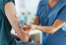 Nurse applying a continuous glucose monitor sensor on arm of a diabetic teenager. CGM device making life of teenage boy easier, helping manage his illness and focus on other activities.