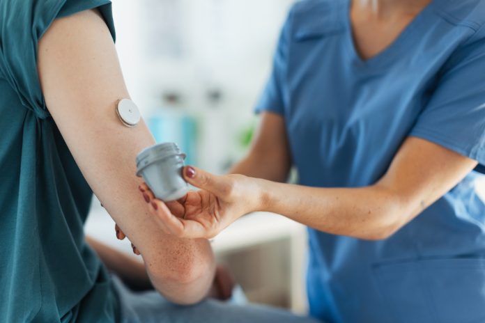 Nurse applying a continuous glucose monitor sensor on arm of a diabetic teenager. CGM device making life of teenage boy easier, helping manage his illness and focus on other activities.