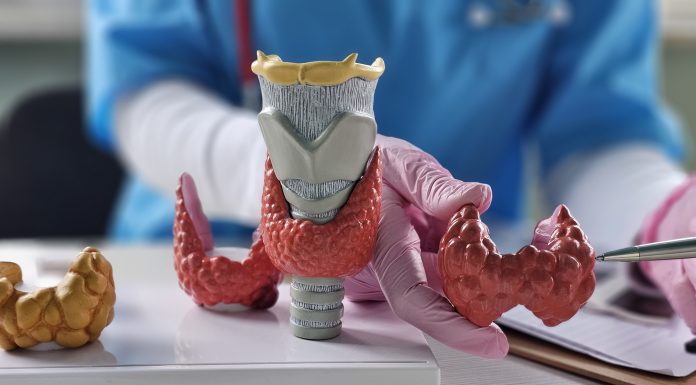 Doctor with human thyroid anatomy model. Thyroid tumor and cancer, postpartum period, papillary carcinoma and health