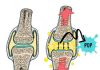 Figure 1 (Created by Dr. Valerie Weiss) - article: Joint manipulation and sounds, how do they arise?