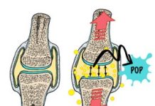 Figure 1 (Created by Dr. Valerie Weiss) - article: Joint manipulation and sounds, how do they arise?