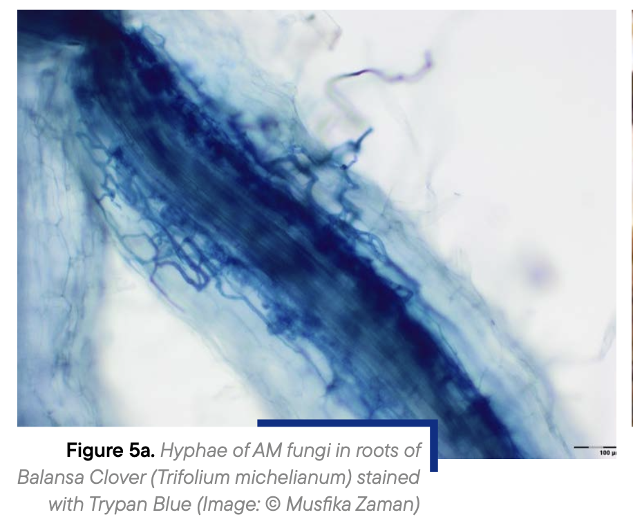Figure 5a. Hyphae of AM fungi in roots of Balansa Clover (Trifolium michelianum) stained with Trypan Blue (Image: © Musfika Zaman)