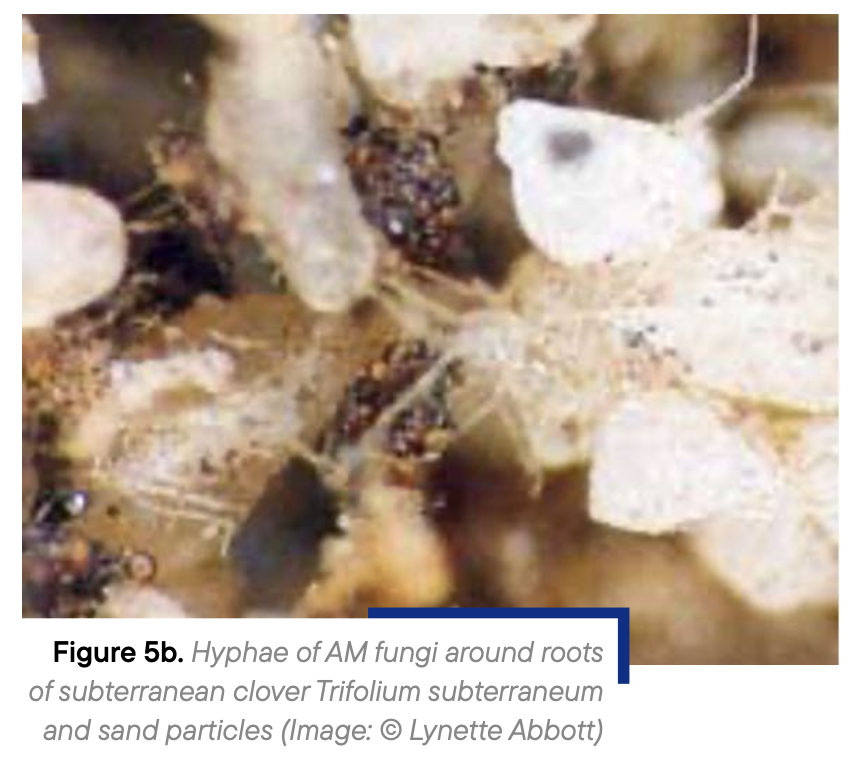 Figure 5b. Hyphae of AM fungi around roots of subterranean clover Trifolium subterraneum and sand particles (Image: © Lynette Abbott)