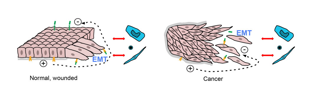 Left, intact epithelium is a continuous sheet with an electrical potential across it, and signal molecules produced on one side (green) that cannot reach receptors (yellow) on the other side. A basement membrane (grey) separates epithelium from other cells. When the sheet is broken, as in a wound, cells change shape (‘EMT’) and send signals that include electric currents and interaction between signal molecules and receptors. The basement membrane may be breached, bringing epithelial cells in contact with other cells. Defence and repair cells (blue) respond. Right, in cancers, the epithelial sheet is disrupted, activating the same wound-healing changes.