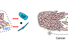 Left, intact epithelium is a continuous sheet with an electrical potential across it, and signal molecules produced on one side (green) that cannot reach receptors (yellow) on the other side. A basement membrane (grey) separates epithelium from other cells. When the sheet is broken, as in a wound, cells change shape (‘EMT’) and send signals that include electric currents and interaction between signal molecules and receptors. The basement membrane may be breached, bringing epithelial cells in contact with other cells. Defence and repair cells (blue) respond. Right, in cancers, the epithelial sheet is disrupted, activating the same wound-healing changes.