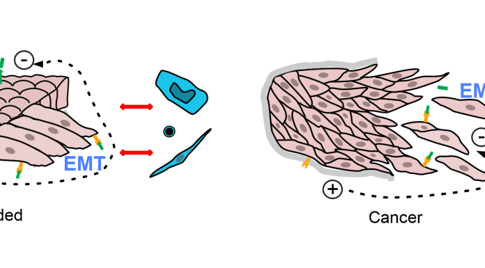 Left, intact epithelium is a continuous sheet with an electrical potential across it, and signal molecules produced on one side (green) that cannot reach receptors (yellow) on the other side. A basement membrane (grey) separates epithelium from other cells. When the sheet is broken, as in a wound, cells change shape (‘EMT’) and send signals that include electric currents and interaction between signal molecules and receptors. The basement membrane may be breached, bringing epithelial cells in contact with other cells. Defence and repair cells (blue) respond. Right, in cancers, the epithelial sheet is disrupted, activating the same wound-healing changes.