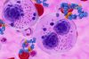 Monoclonal antibody treatment in Multiple myeloma (MM) - closeup view 3d illustration