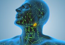 Lymphomas are a type of cancer that starts in the lymphatic system when abnormal white blood cells grow. The lymphatic system is made up of lymph glands throughout the body.