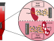 Figure 1. Microbial electrochemical fluidized bed reactor under anodic and cathodic conditions to stimulate wastewater removal and PHB production, respectively.