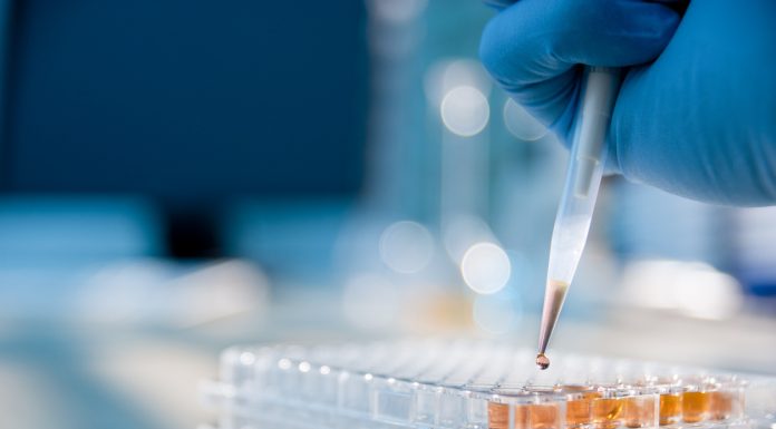 Lab technician injecting liquid into a microtiter plate