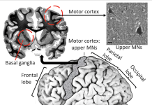 Figure 1. HIE vulnerable human brain regions.