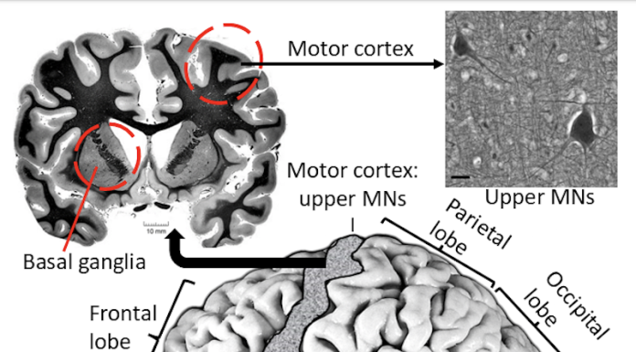 Figure 1. HIE vulnerable human brain regions.