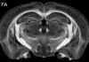 Figure 1: Diffusion tensor imaging produces ten 3D volumes highlighting different cytoarchitecture. Selected volumes include: MD- mean diffusivity follows the integrity of cortical layers, layers in the hippocampus and thalamic nuclei. FA- fractional anisotropy provides a measure of white matter health. ClrTDI- Color track density shows local fiber tracks with color indicating local direction of the fibers (Red- left/ right; Green- in/out of plane; Blue top/bottom. Fiber tracking allows one to measure the global and local connectivity in the whole brain. The resolution in the TDI is 5 μm. The inset (1 mm wide) shows a magnified region of hippocampus in which apical dendrites are visible.