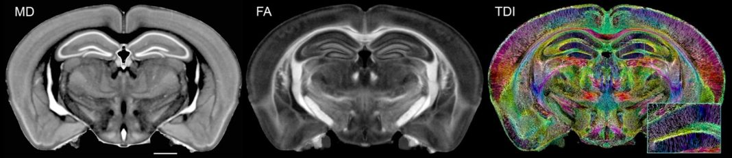 Figure 1: Diffusion tensor imaging produces ten 3D volumes highlighting different cytoarchitecture. Selected volumes include: MD- mean diffusivity follows the integrity of cortical layers, layers in the hippocampus and thalamic nuclei. FA- fractional anisotropy provides a measure of white matter health. ClrTDI- Color track density shows local fiber tracks with color indicating local direction of the fibers (Red- left/ right; Green- in/out of plane; Blue top/bottom. Fiber tracking allows one to measure the global and local connectivity in the whole brain. The resolution in the TDI is 5 μm. The inset (1 mm wide) shows a magnified region of hippocampus in which apical dendrites are visible.