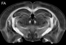 Figure 1: Diffusion tensor imaging produces ten 3D volumes highlighting different cytoarchitecture. Selected volumes include: MD- mean diffusivity follows the integrity of cortical layers, layers in the hippocampus and thalamic nuclei. FA- fractional anisotropy provides a measure of white matter health. ClrTDI- Color track density shows local fiber tracks with color indicating local direction of the fibers (Red- left/ right; Green- in/out of plane; Blue top/bottom. Fiber tracking allows one to measure the global and local connectivity in the whole brain. The resolution in the TDI is 5 μm. The inset (1 mm wide) shows a magnified region of hippocampus in which apical dendrites are visible.