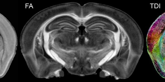 Figure 1: Diffusion tensor imaging produces ten 3D volumes highlighting different cytoarchitecture. Selected volumes include: MD- mean diffusivity follows the integrity of cortical layers, layers in the hippocampus and thalamic nuclei. FA- fractional anisotropy provides a measure of white matter health. ClrTDI- Color track density shows local fiber tracks with color indicating local direction of the fibers (Red- left/ right; Green- in/out of plane; Blue top/bottom. Fiber tracking allows one to measure the global and local connectivity in the whole brain. The resolution in the TDI is 5 μm. The inset (1 mm wide) shows a magnified region of hippocampus in which apical dendrites are visible.